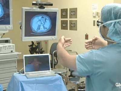Kinect будет использоваться при операциях в медицине